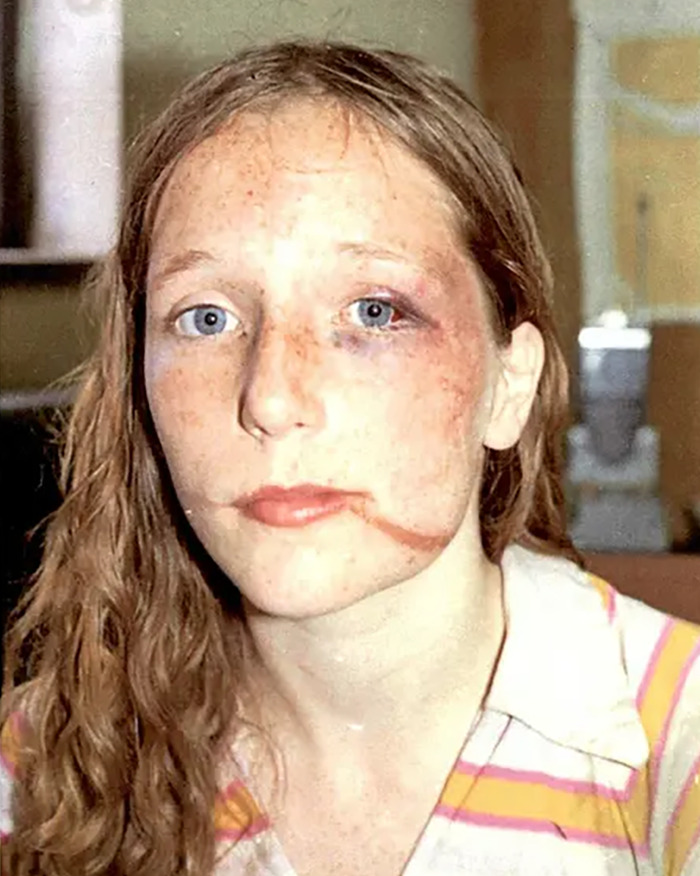 Teen Chewed Through Ropes To Escape Homicide In Serial Spree, Survival Story Resurfaces In Podcast