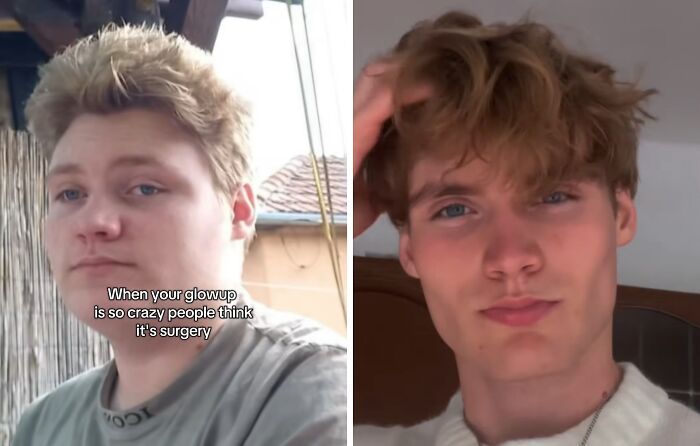 46 People Who Gained Back Their Confidence After Spectacular Glow-Ups