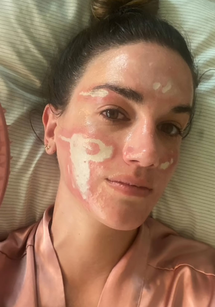 &#8220;She Ruined Me&#8221;: Woman Claims $90,000 Repairs After Celebrity Facialist “Permanently Disfigured” Her