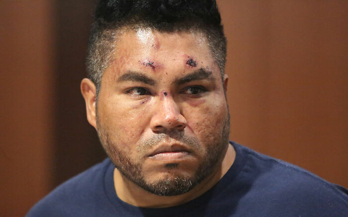 Maniac Driver Gives Shocking Response To Cops After Running Over Teen Who Rejected His Advances