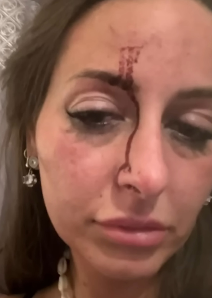 Domestic Violence Victim Reveals How Siri Saved Her Life During Horrifying Attack