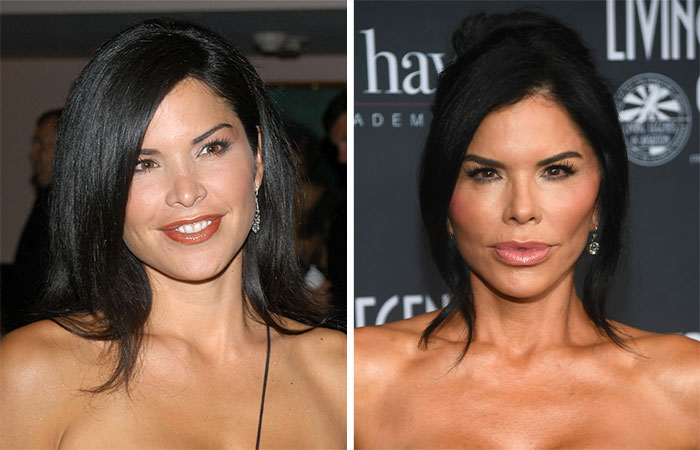 29 Celebrities Fans Believe Ruined Their Beauty With Buccal Fat Removal