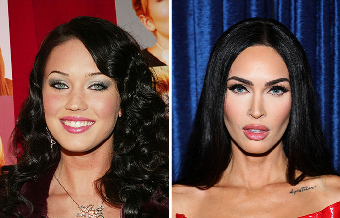 29 Celebrities Fans Believe Ruined Their Beauty With Buccal Fat Removal