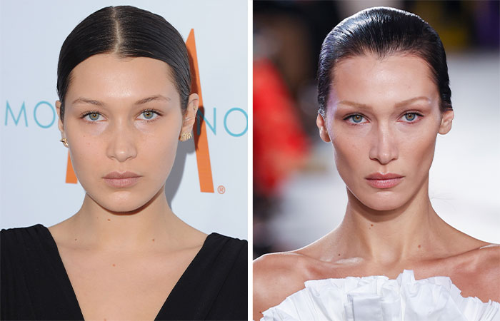 29 Celebrities Fans Believe Ruined Their Beauty With Buccal Fat Removal
