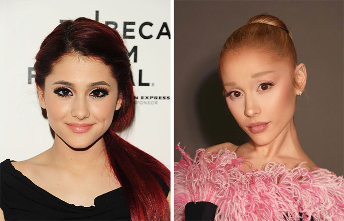 29 Celebrities Fans Believe Ruined Their Beauty With Buccal Fat Removal
