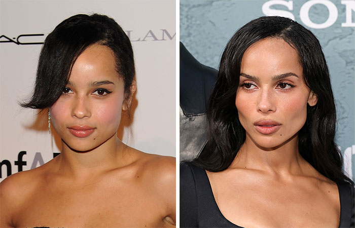 29 Celebrities Fans Believe Ruined Their Beauty With Buccal Fat Removal