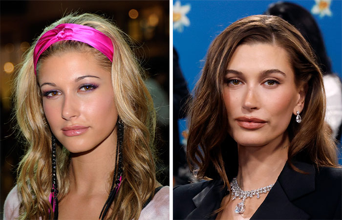 29 Celebrities Fans Believe Ruined Their Beauty With Buccal Fat Removal