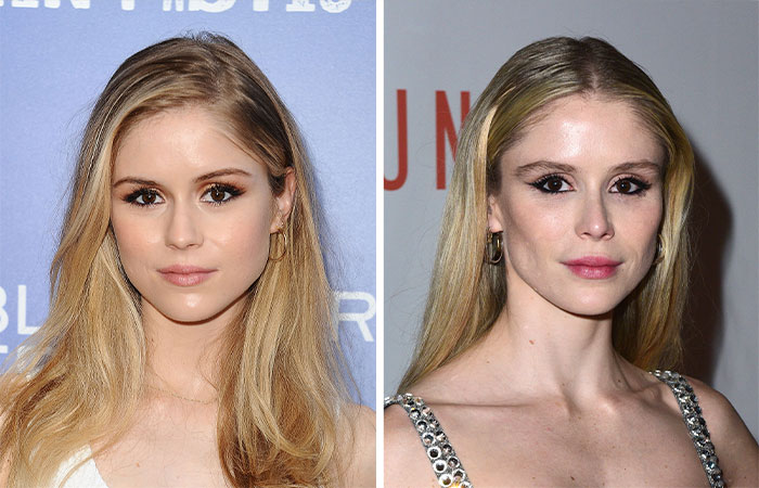 29 Celebrities Fans Believe Ruined Their Beauty With Buccal Fat Removal