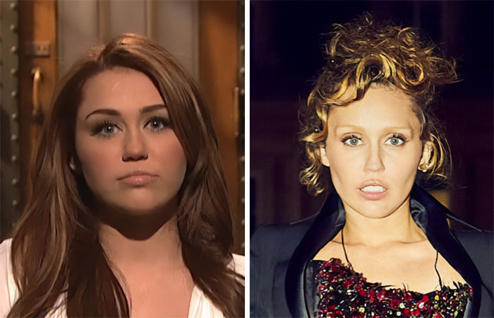29 Celebrities Fans Believe Ruined Their Beauty With Buccal Fat Removal