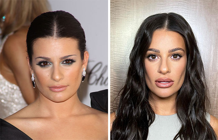 29 Celebrities Fans Believe Ruined Their Beauty With Buccal Fat Removal