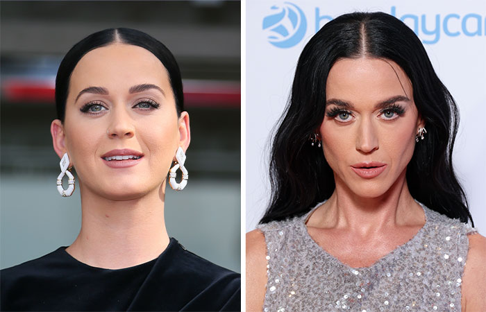 29 Celebrities Fans Believe Ruined Their Beauty With Buccal Fat Removal