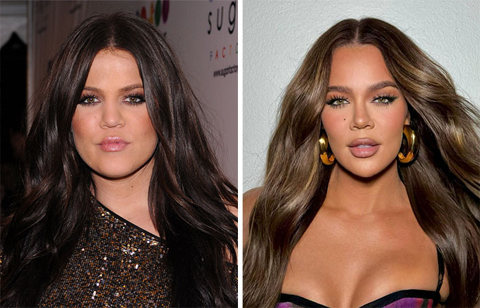 29 Celebrities Fans Believe Ruined Their Beauty With Buccal Fat Removal
