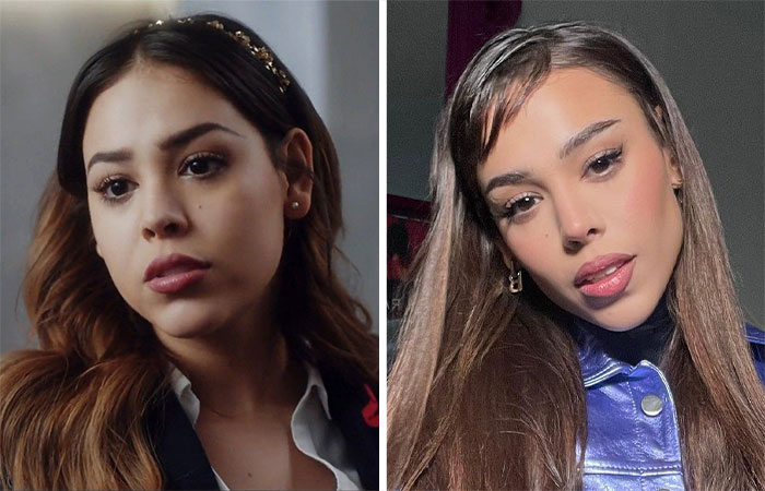 29 Celebrities Fans Believe Ruined Their Beauty With Buccal Fat Removal