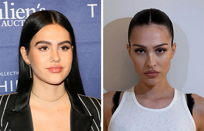 29 Celebrities Fans Believe Ruined Their Beauty With Buccal Fat Removal