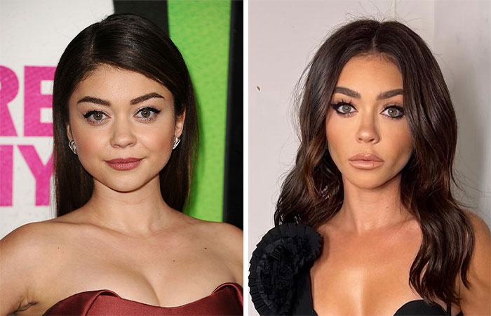 29 Celebrities Fans Believe Ruined Their Beauty With Buccal Fat Removal