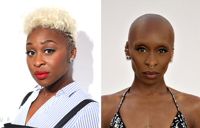 29 Celebrities Fans Believe Ruined Their Beauty With Buccal Fat Removal