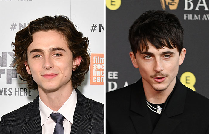 29 Celebrities Fans Believe Ruined Their Beauty With Buccal Fat Removal