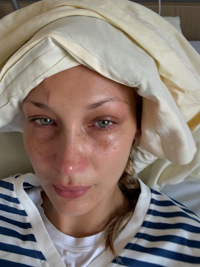 After Revealing “Years Of Invisible Suffering,” Bella Hadid Posts Alarming Photos From Hospital