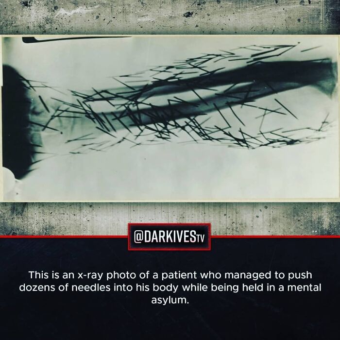 72 Disturbing Facts That Fans Of This Instagram Page Can’t Get Enough Of