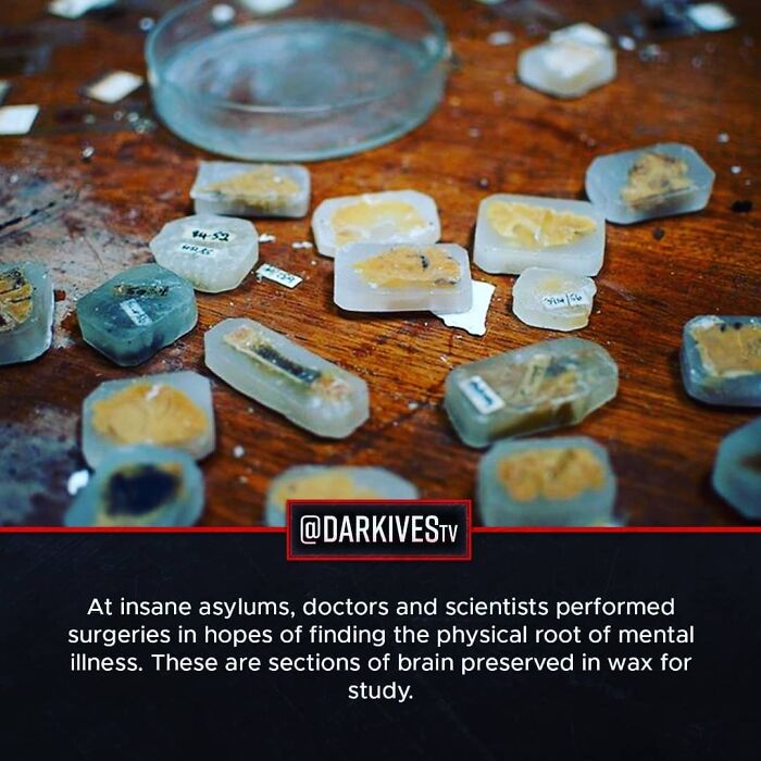 72 Disturbing Facts That Fans Of This Instagram Page Can’t Get Enough Of