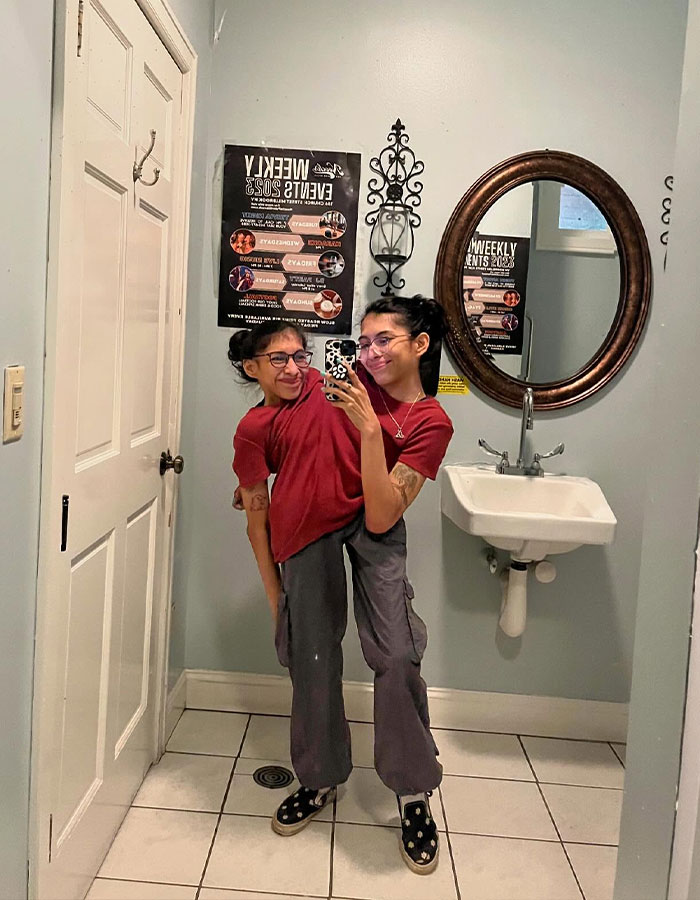 Conjoined Twin Carmen Andrade Hits Back at Backlash Over Her Intimate Life With Husband