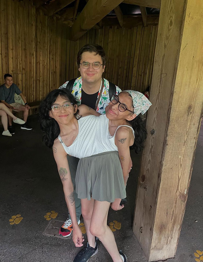 Conjoined Twin Carmen Andrade Hits Back at Backlash Over Her Intimate Life With Husband