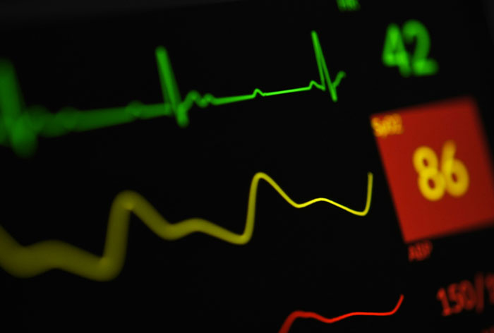 ER Nurses Share Wild “One More Minute And I’d Be Dead” Stories From The Hospital