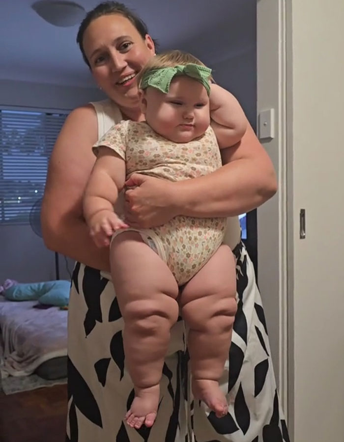 Doctors Sound Alarm Over Concerning Cause Behind Rise In Giant Baby Births
