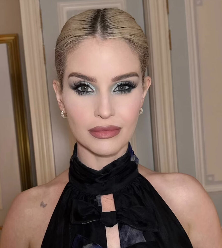 30 Before-And-After Photos Of Stars Who Were Accused Of Using Ozempic