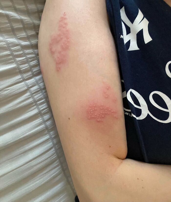 55 People Who Had The Worst Luck On Vacation Shared Pics Of What Happened 55 People Who Had The Worst Luck On Vacation Shared Pics Of What Happened