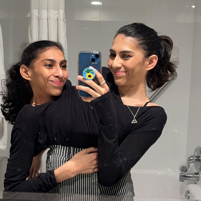 Conjoined Twin And Husband Break Silence On Intimacy In Their Marriage After People Ask Intrusive Questions