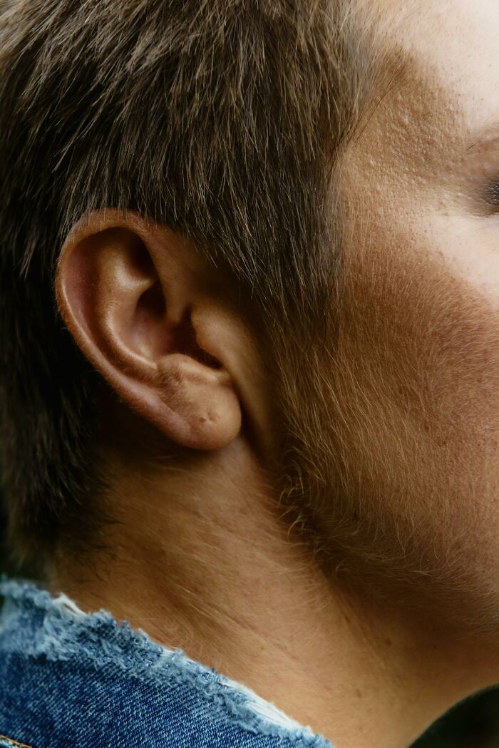 42 Times Doctors Encountered A Patient With A Rare Disease