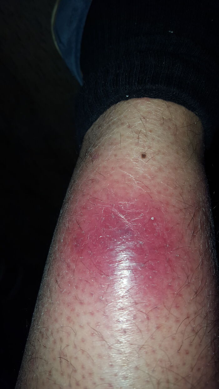 42 Times Doctors Encountered A Patient With A Rare Disease