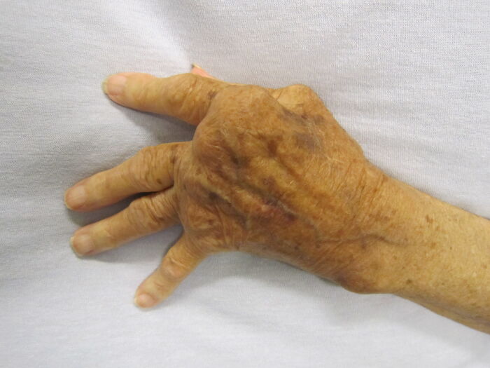 42 Times Doctors Encountered A Patient With A Rare Disease