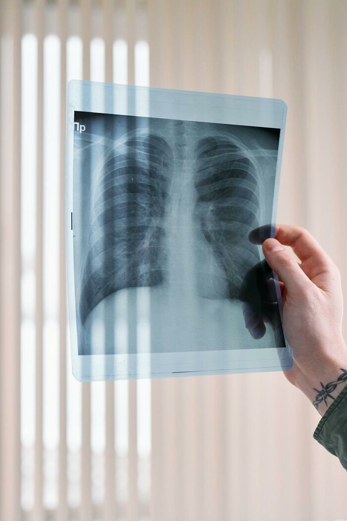 42 Times Doctors Encountered A Patient With A Rare Disease