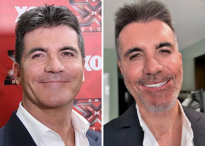 After A Bike Accident He Was &#8220;Lucky&#8221; To Survive, Viral Clip Of Simon Cowell Raises Worry Among Fans
