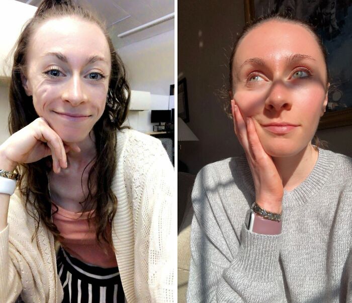 71 Of The Best Glow-Ups That Might Make You Smile