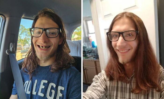71 Of The Best Glow-Ups That Might Make You Smile