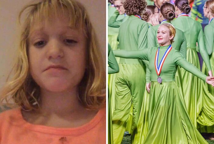 71 Of The Best Glow-Ups That Might Make You Smile