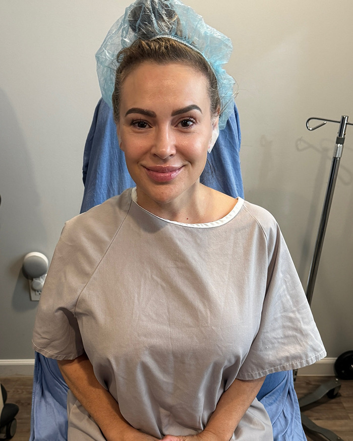 “That Was Never Me”: Alyssa Milano Explains Why She Decided To Remove Her Breast Implants