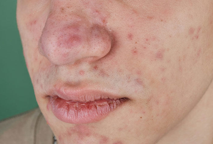“This Does Not Happen To Men”: 77 Of The Most Downplayed Medical Conditions And Procedures