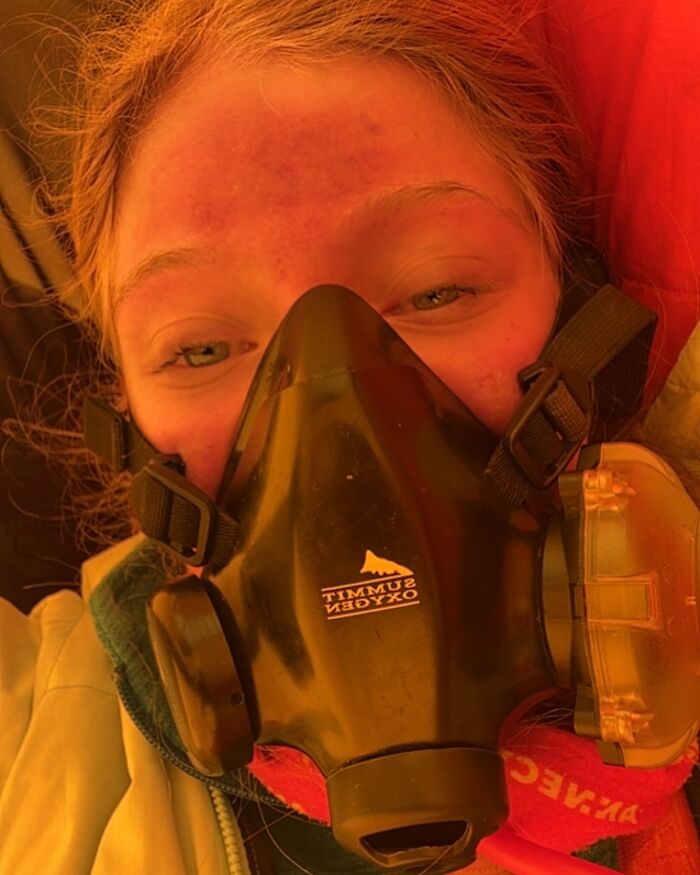 Severely Injured After Everest Climb, 17YO Teen Sparks Online Debate: “Why Take The Risk?”