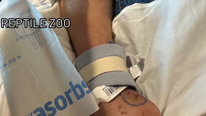 Paramedics Face Disciplinary Action For Giving Life-Saving Antivenom To Snakebite Victim