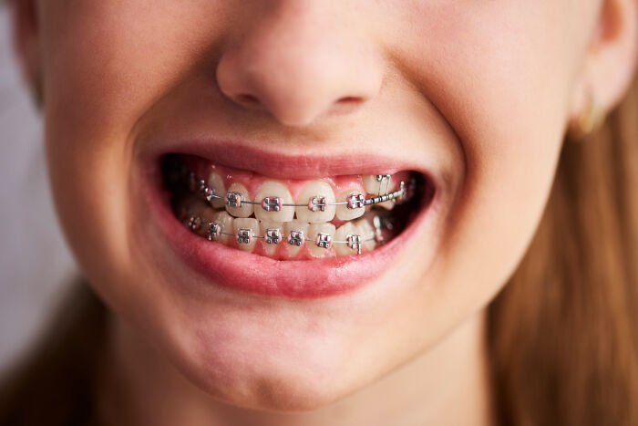 Autistic Kid Says He Doesn&#8217;t Like Braces, Mom Tries To Explain But Dentist Threatens To Report Her