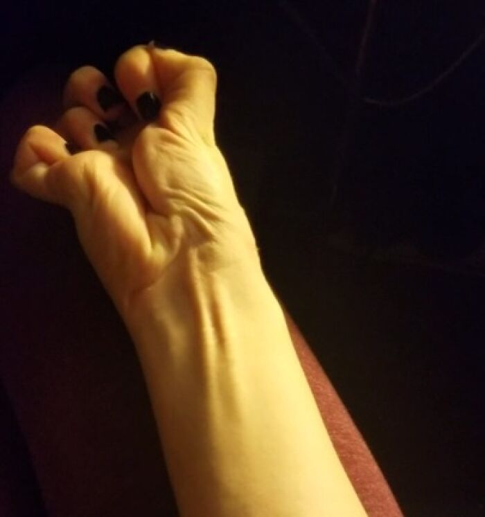74 People Share Rare And Surprising Things About Their Bodies (New Pics)