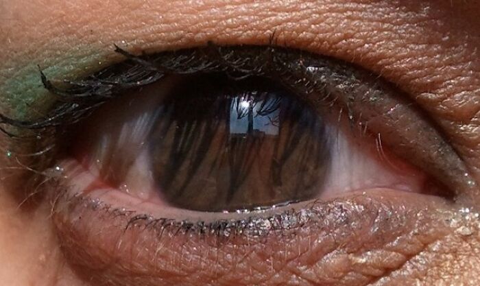 74 People Share Rare And Surprising Things About Their Bodies (New Pics)