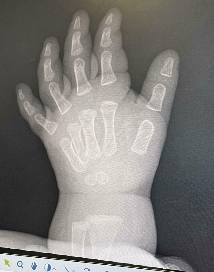 74 People Share Rare And Surprising Things About Their Bodies (New Pics)