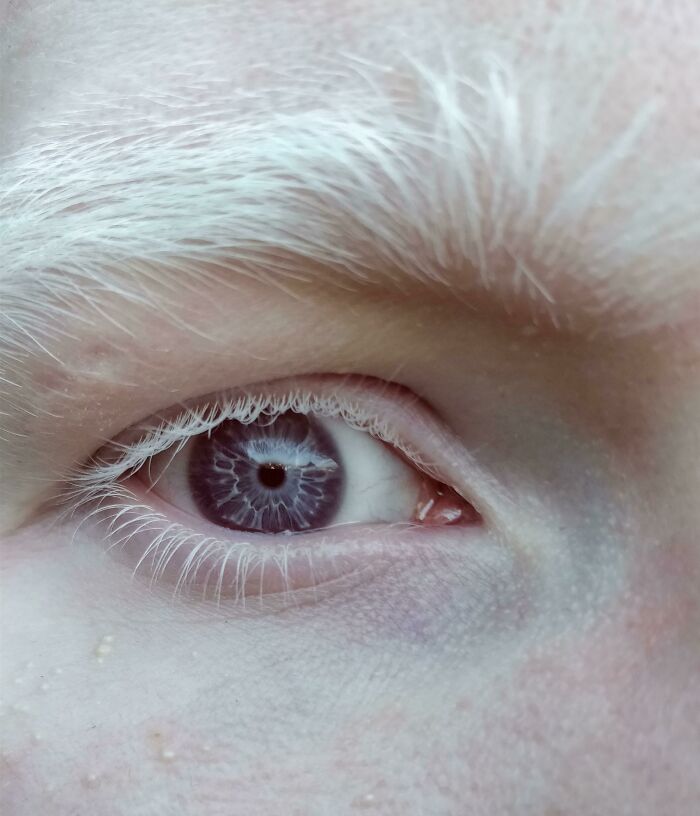 74 People Share Rare And Surprising Things About Their Bodies (New Pics)