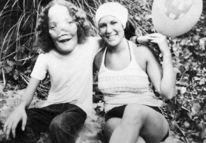 74 People Share Rare And Surprising Things About Their Bodies (New Pics)