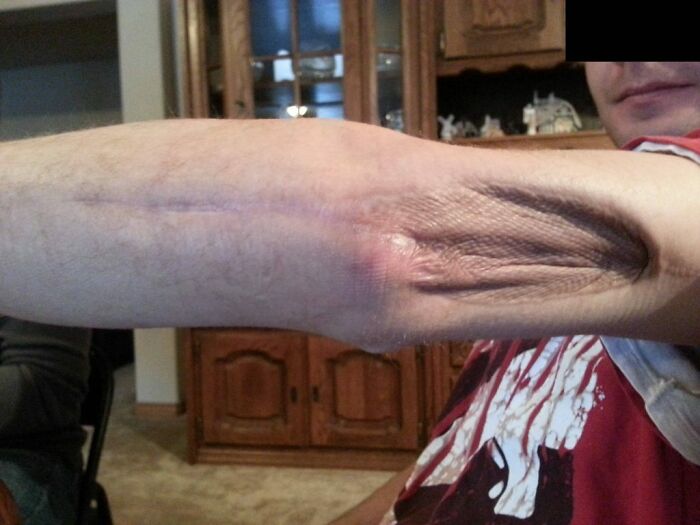 74 People Share Rare And Surprising Things About Their Bodies (New Pics)